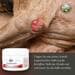 Bellfor Callus Ointment, 30ml